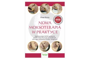 Nowa moksoterapia w praktyce  Oran Kivity